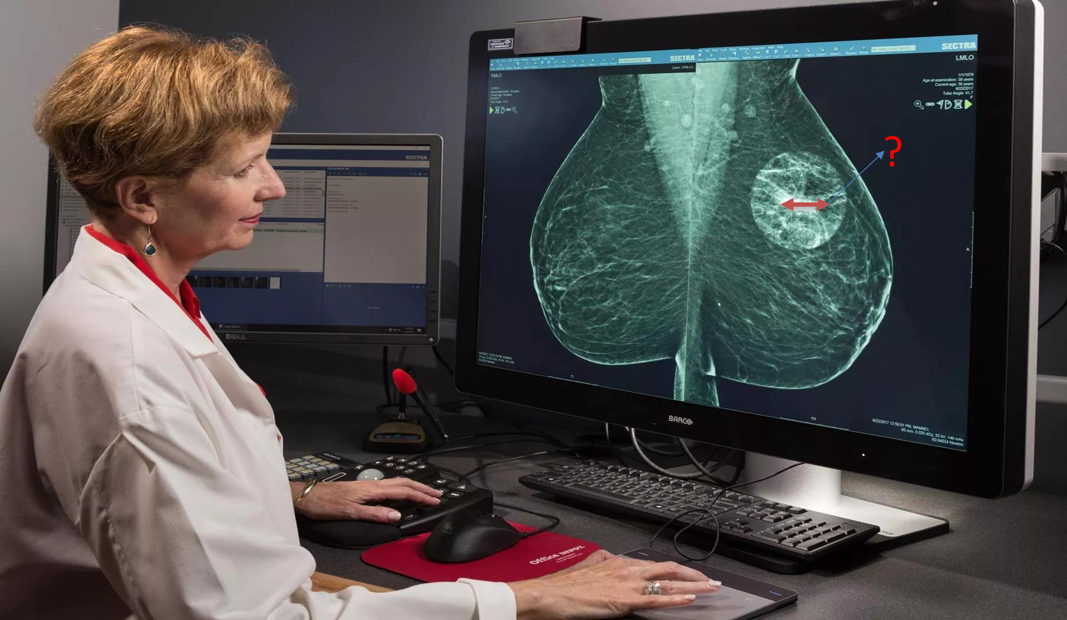 Mammography Image